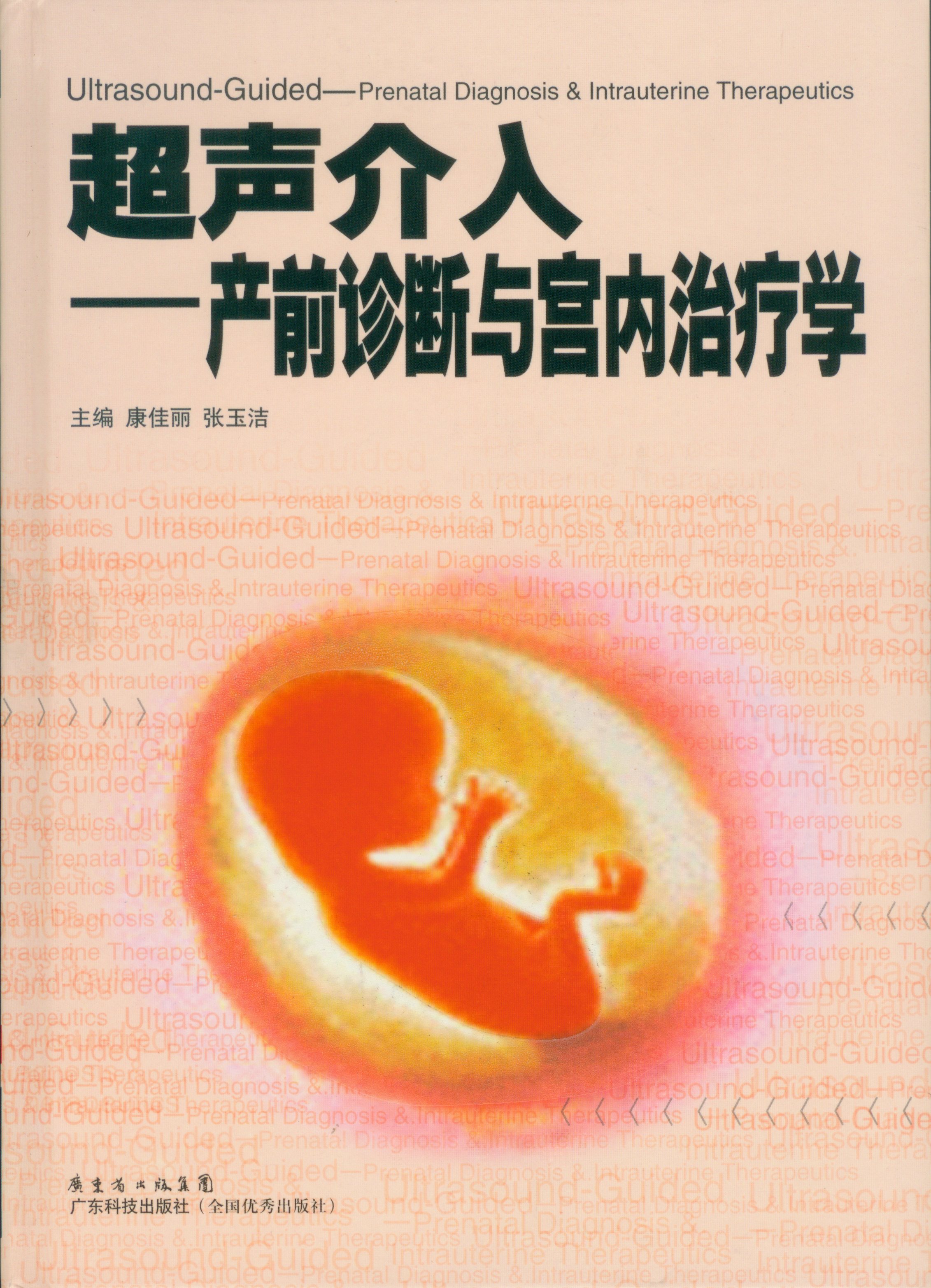 超声介入——产前诊断与宫内治疗学