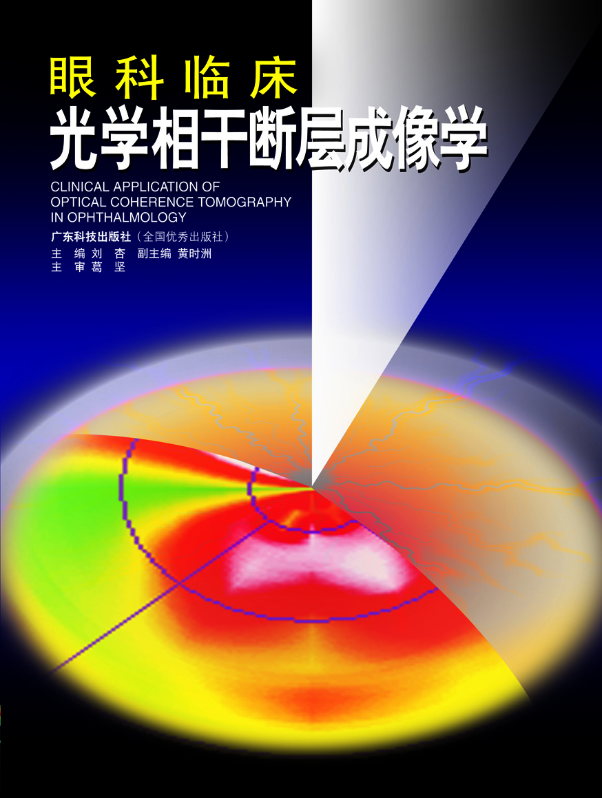 眼科临床光学相干断层成像学