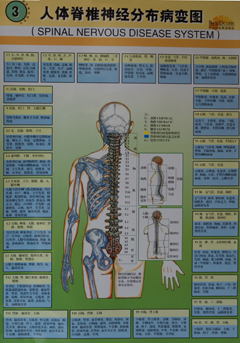 人体脊髓神经分布病变图