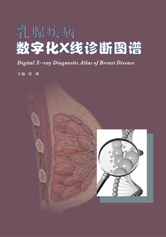 乳腺疾病数字化X线诊断图谱